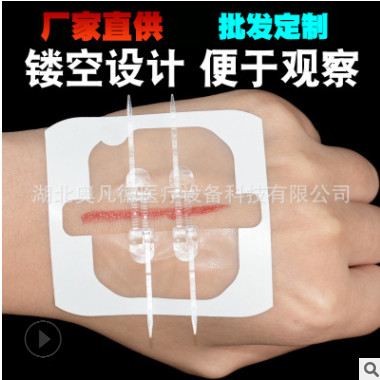 朗特彈性綁帶減張器拉鏈式創貼傷口縫合貼拉鏈創貼免縫針創口