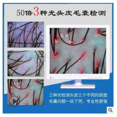 頭皮檢測儀毛囊頭發測試儀器理發店高清放大器一體機皮膚分析護理