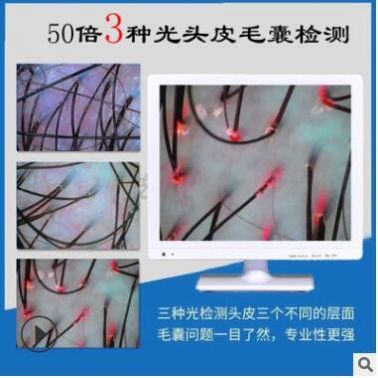 頭皮檢測儀毛囊頭發測試儀器理發店高清放大器一體機皮膚分析護理